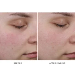 Pore Refining Complex