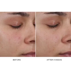 Pore Refining Complex