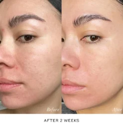 Skin Activator Refill
