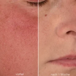 Stabilizing Repair Cream