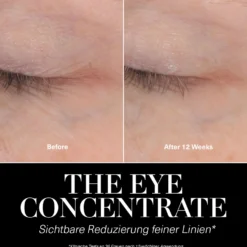 The Eye Concentrate