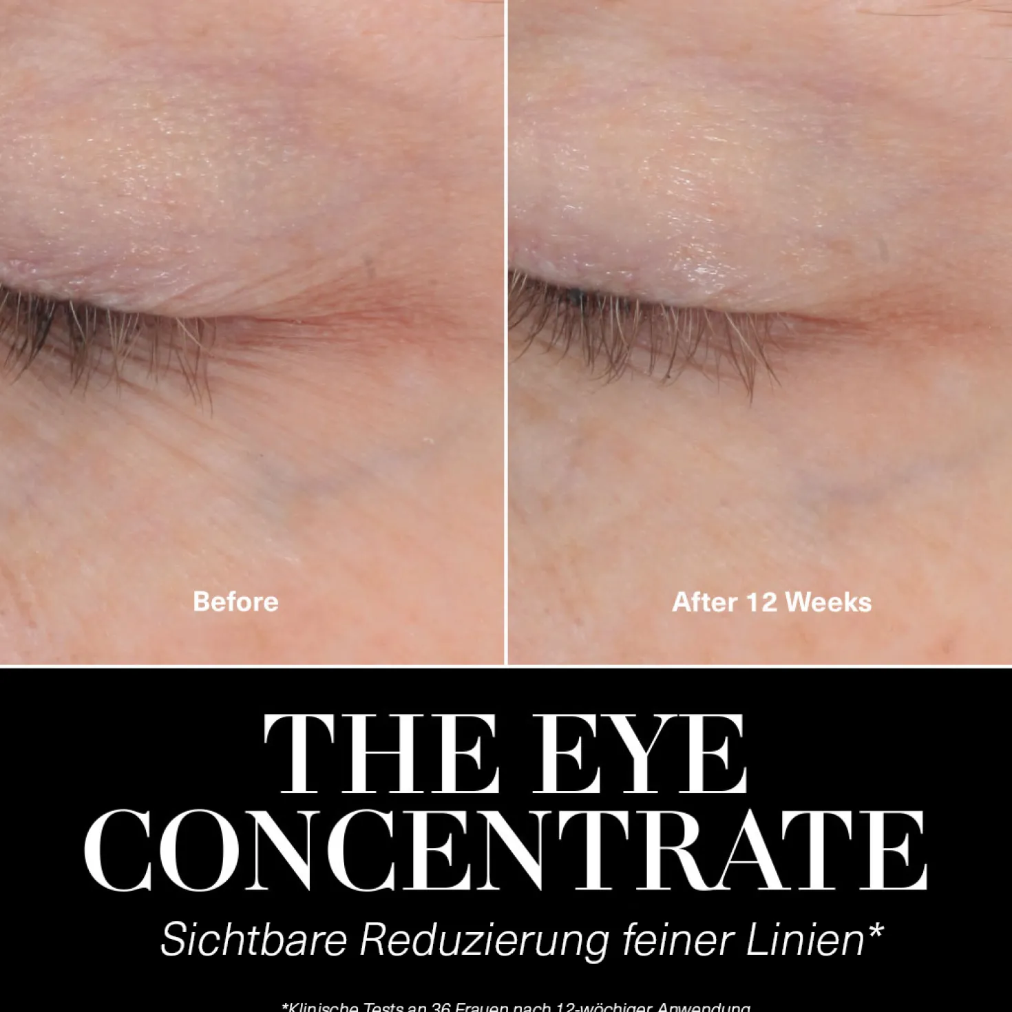 The Eye Concentrate