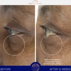The Eye Cream Nomad