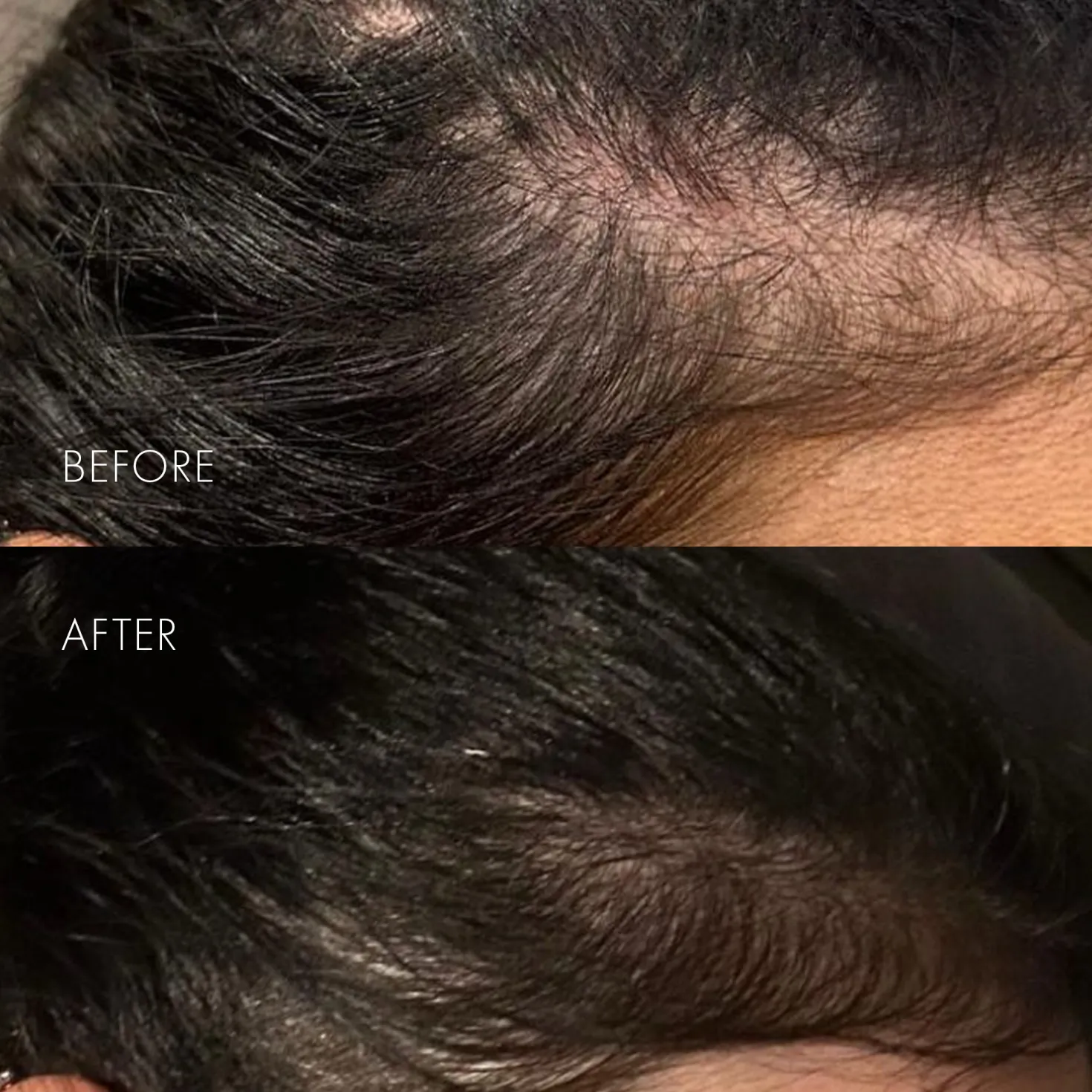 The Hair Serum