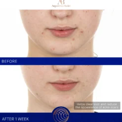 The Retinol Serum