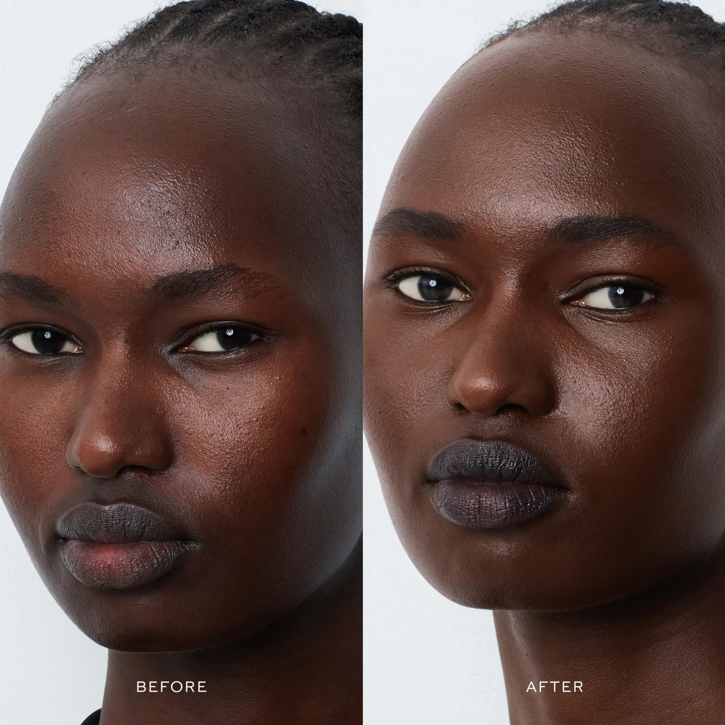Vital Skincare Complexion Drops XV