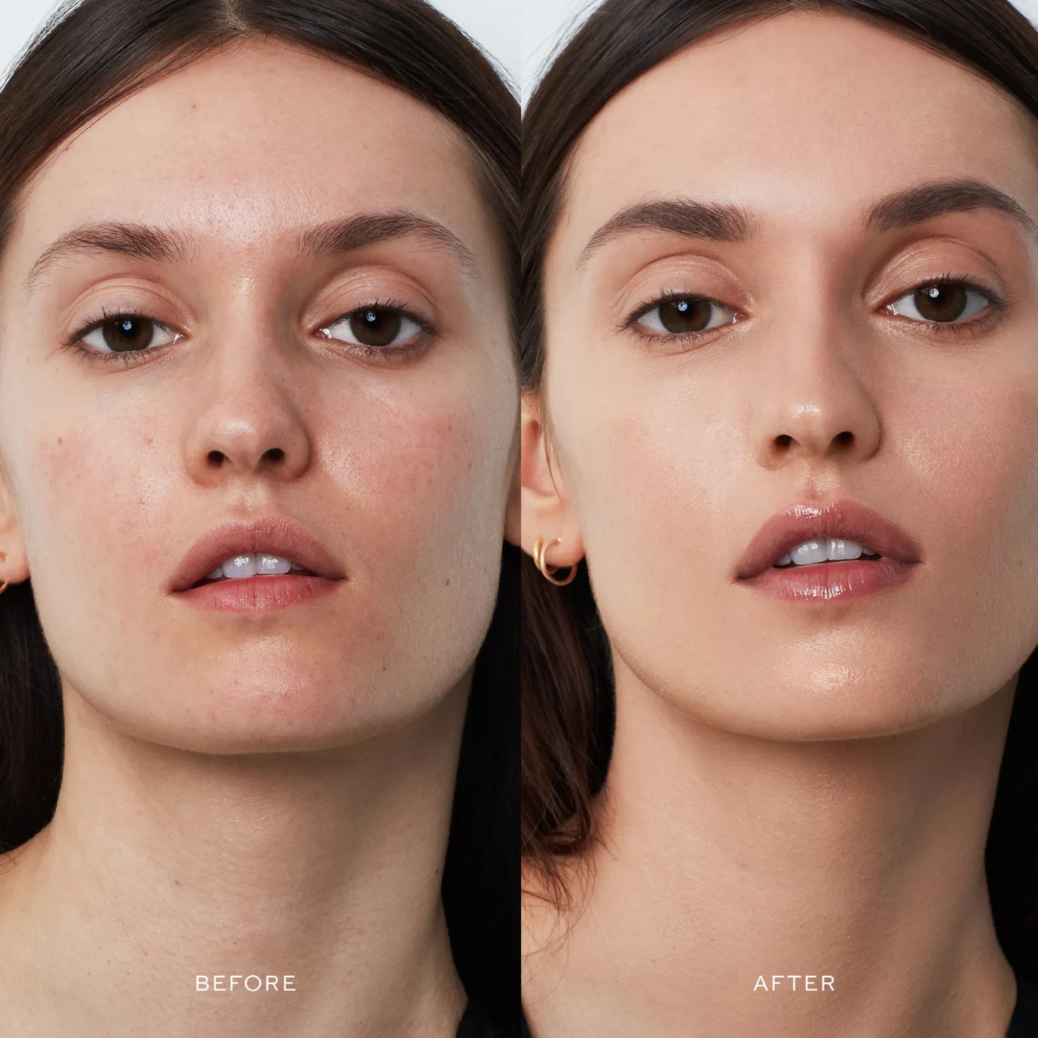 Vital Skincare Complexion Drops XIV
