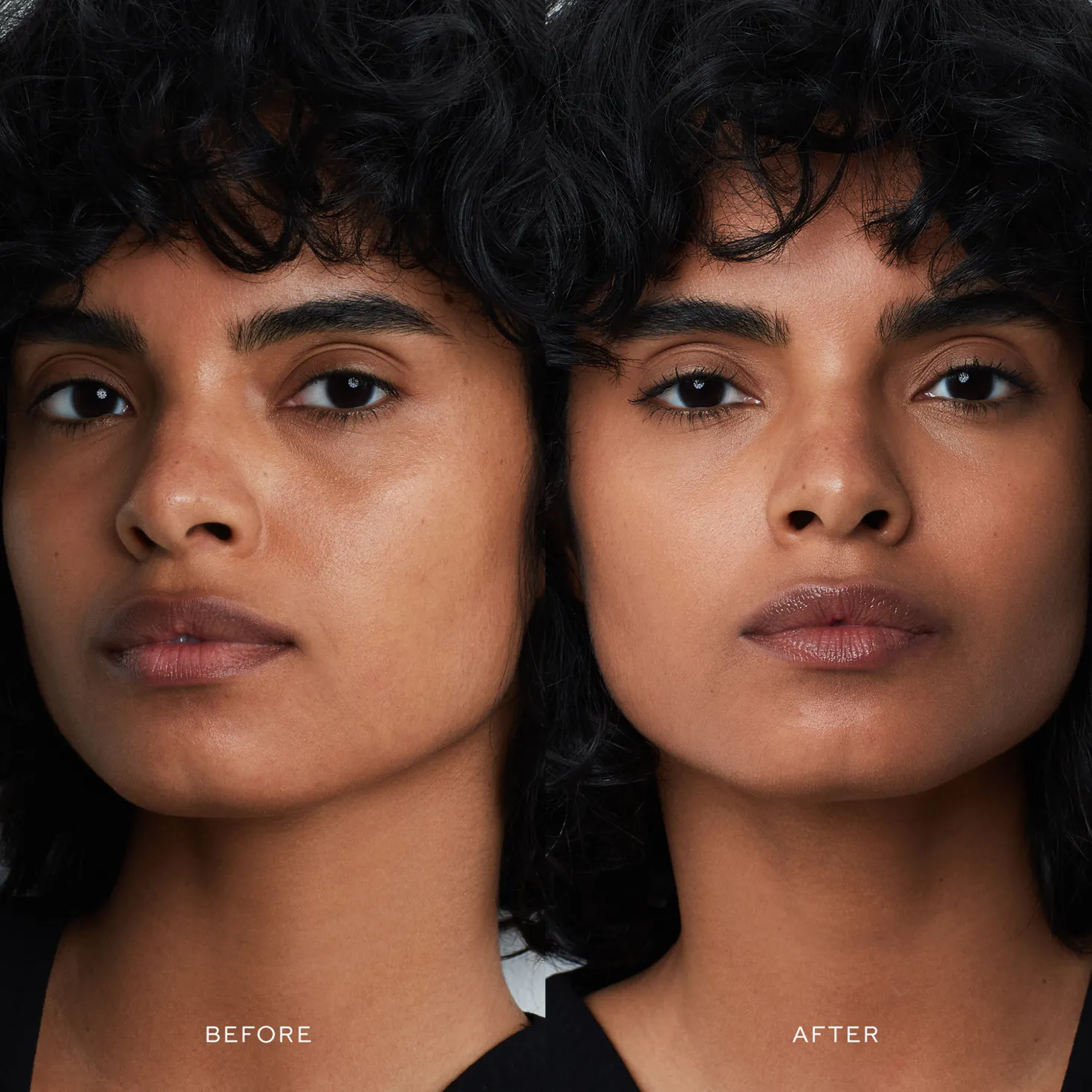 Vital Skincare Complexion Drops X