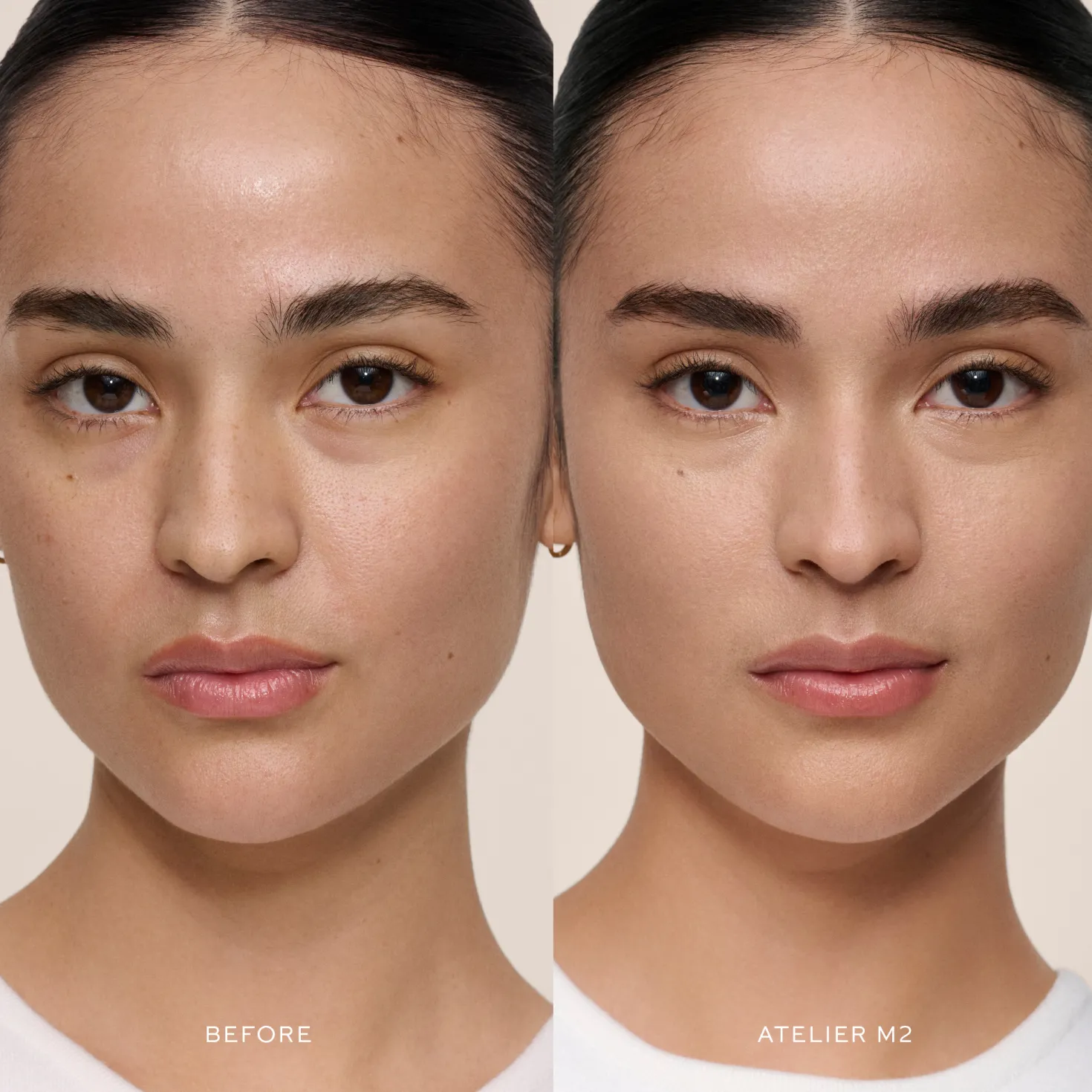 Vital Skincare Concealer M2